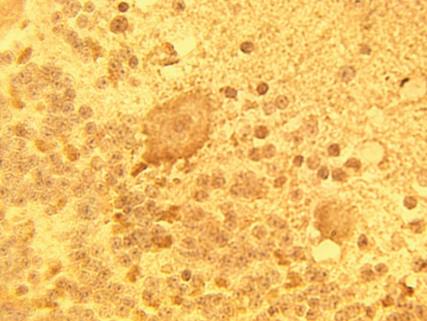 Rabbit anti Human Degenerative Spermatocyte Homolog 1 (DEGS1) Antibody