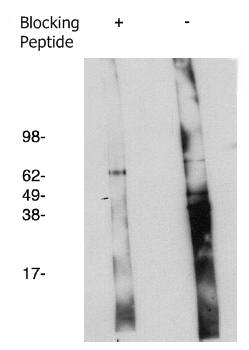 Rabbit anti Human Degenerative Spermatocyte Homolog 2 (DEGS2) Antibody