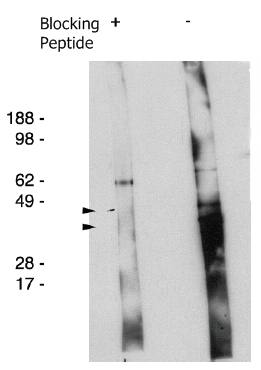 Rabbit anti Human Degenerative Spermatocyte Homolog 2 Antibody