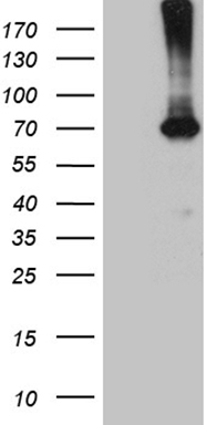 delta Sarcoglycan Antibody