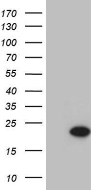 delta Sarcoglycan Antibody