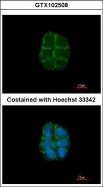 Desmoglein 2 Rabbit Polyclonal Antibody