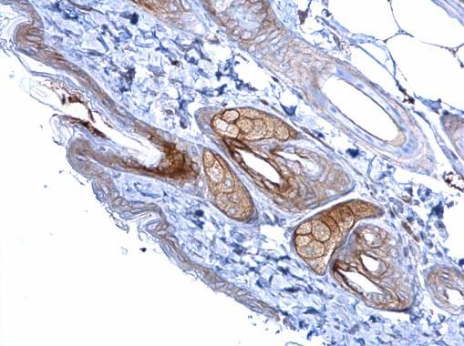 Desmoglein 2 Rabbit Polyclonal Antibody