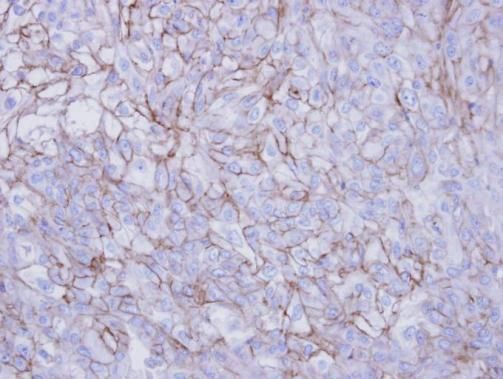 Desmoglein 2 Rabbit Polyclonal Antibody