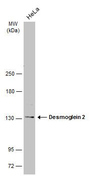 Desmoglein 2 Rabbit Polyclonal Antibody