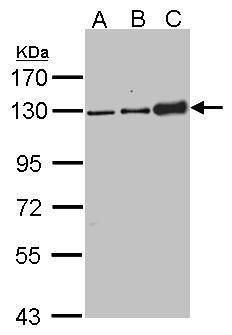 Desmoglein 2 Rabbit Polyclonal Antibody