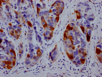 DHFR Antibody