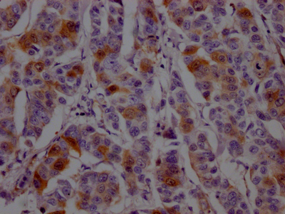 DHFR Antibody