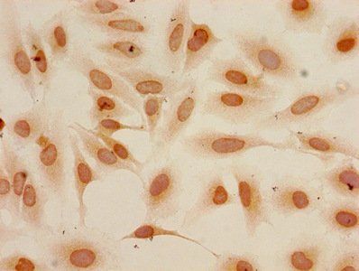 HIST1H3A Antibody