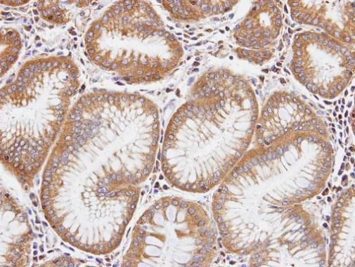 DIAPH1 Rabbit Polyclonal Antibody