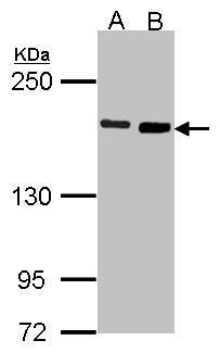 DIAPH1 Rabbit Polyclonal Antibody