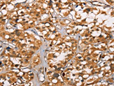 DICER1 Antibody