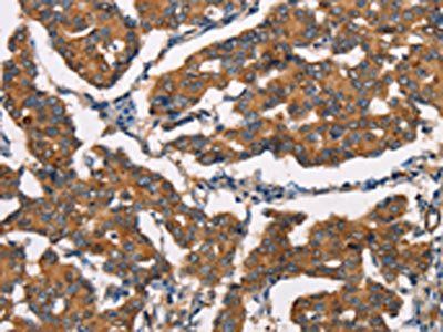 DICER1 Antibody