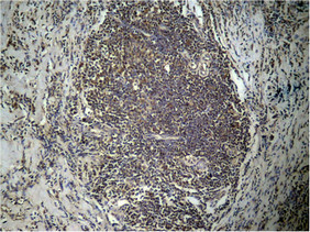 HIST1H3A Antibody