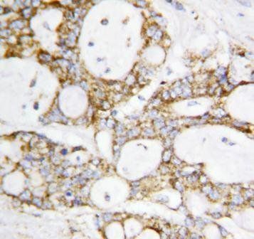 Lipoamide Dehydrogenase/DLD Rabbit Polyclonal Antibody