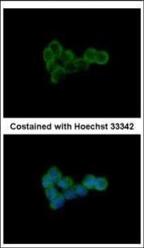 DLST Rabbit Polyclonal Antibody