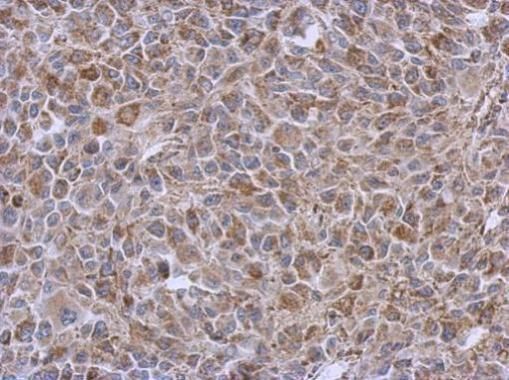 DLST Rabbit Polyclonal Antibody