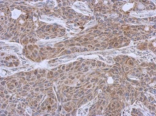 DLST Rabbit Polyclonal Antibody