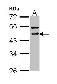 DLST Rabbit Polyclonal Antibody