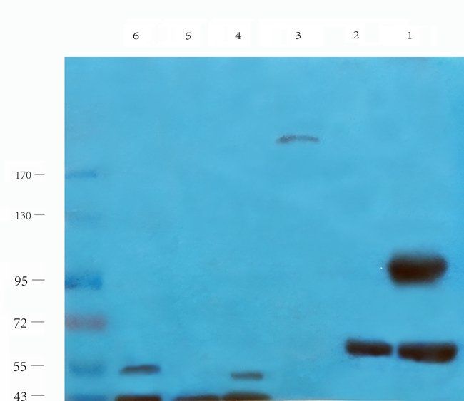 DNA polymerase theta Rabbit Polyclonal Antibody