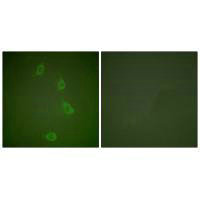 DNAJB1 Antibody