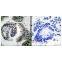DNAJB1 Antibody