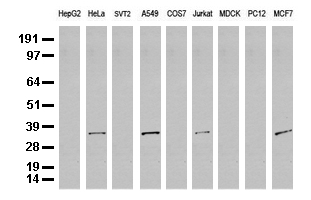 DNAJB5 Antibody