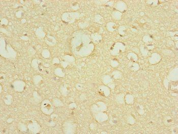 DNAJC19 Antibody