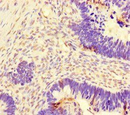 DNAJC3 Antibody