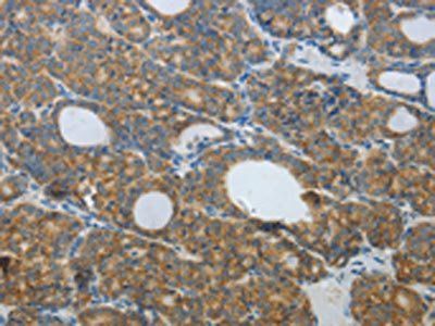DNAJC3 Antibody