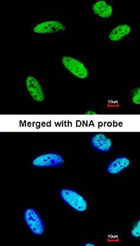 DNAJC7 Rabbit Polyclonal Antibody
