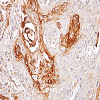 DNAJC7 Rabbit Polyclonal Antibody
