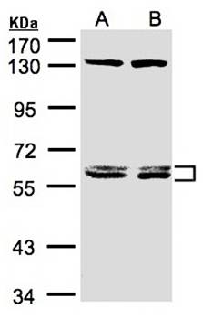 DNAJC7 Rabbit Polyclonal Antibody