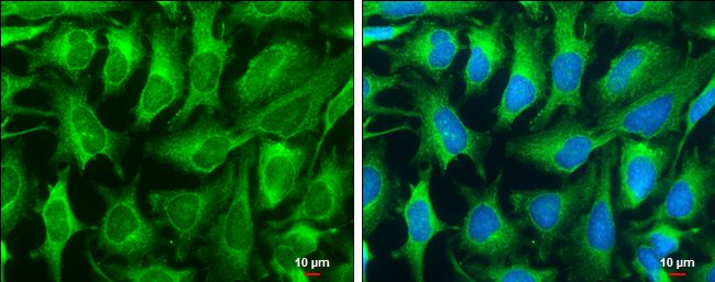 DNase I Rabbit Polyclonal Antibody