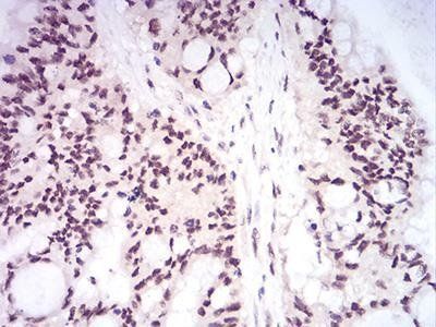DNMT1 Antibody