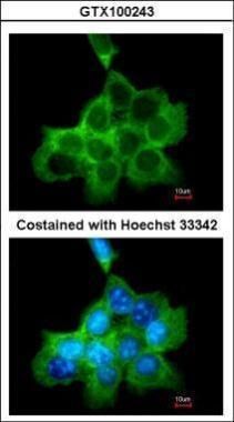 DOCK1 Rabbit Polyclonal Antibody