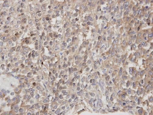 DOCK1 Rabbit Polyclonal Antibody
