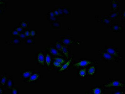DAD1 Antibody