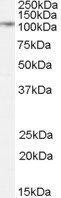 DPP4/CD26 Antibody
