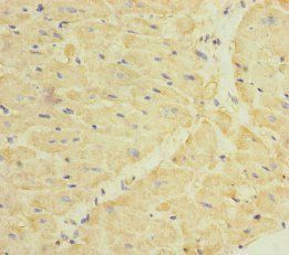 DPT Antibody
