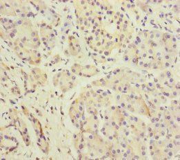 DPT Antibody
