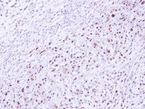 DRAK1 Rabbit Polyclonal Antibody
