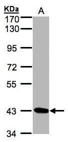DRAK1 Rabbit Polyclonal Antibody