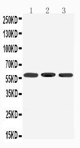 Dopamine Receptor D5/DRD5 Rabbit Polyclonal Antibody