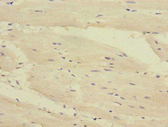 DSC1 Antibody
