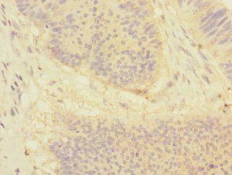 DSC1 Antibody