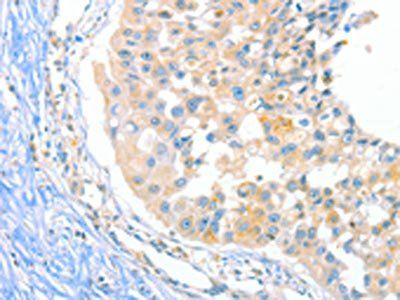 DUSP14 Antibody