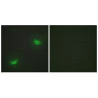 DUSP16 Antibody