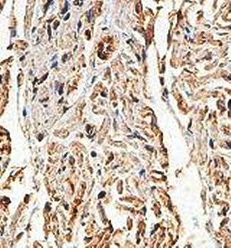 DUSP22 Rabbit Polyclonal Antibody