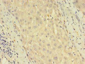 DUSP26 Antibody